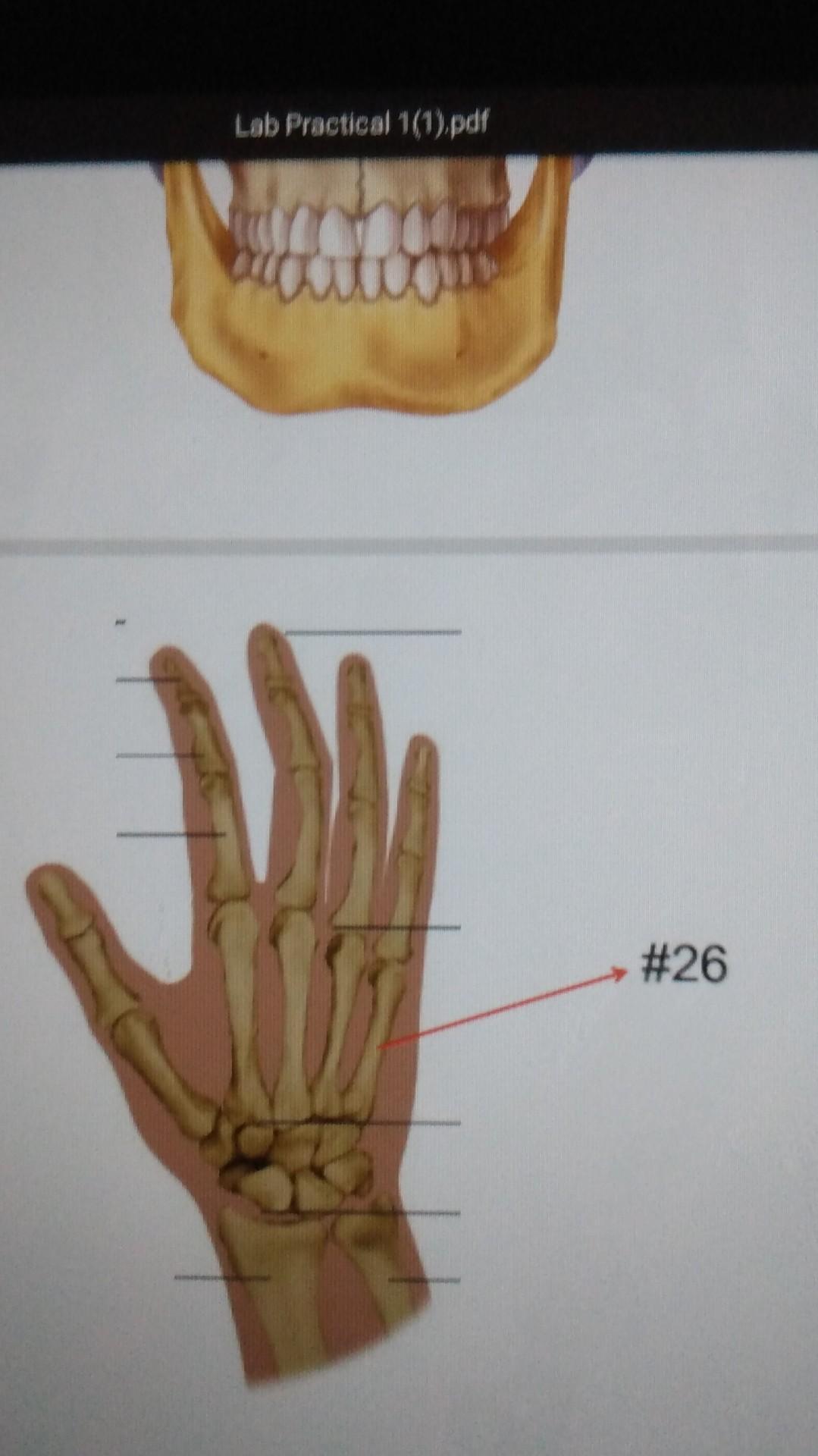 Solved Lab Practical 1(1).pdf #22 *Name the 