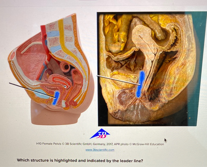 Solved D H10 Female Pelvis 3b Scientific Gmbh Germany Chegg Com