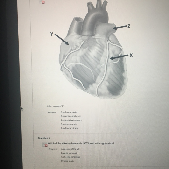 Solved "Y" is which chamber of the heart? Answers: A. right | Chegg.com