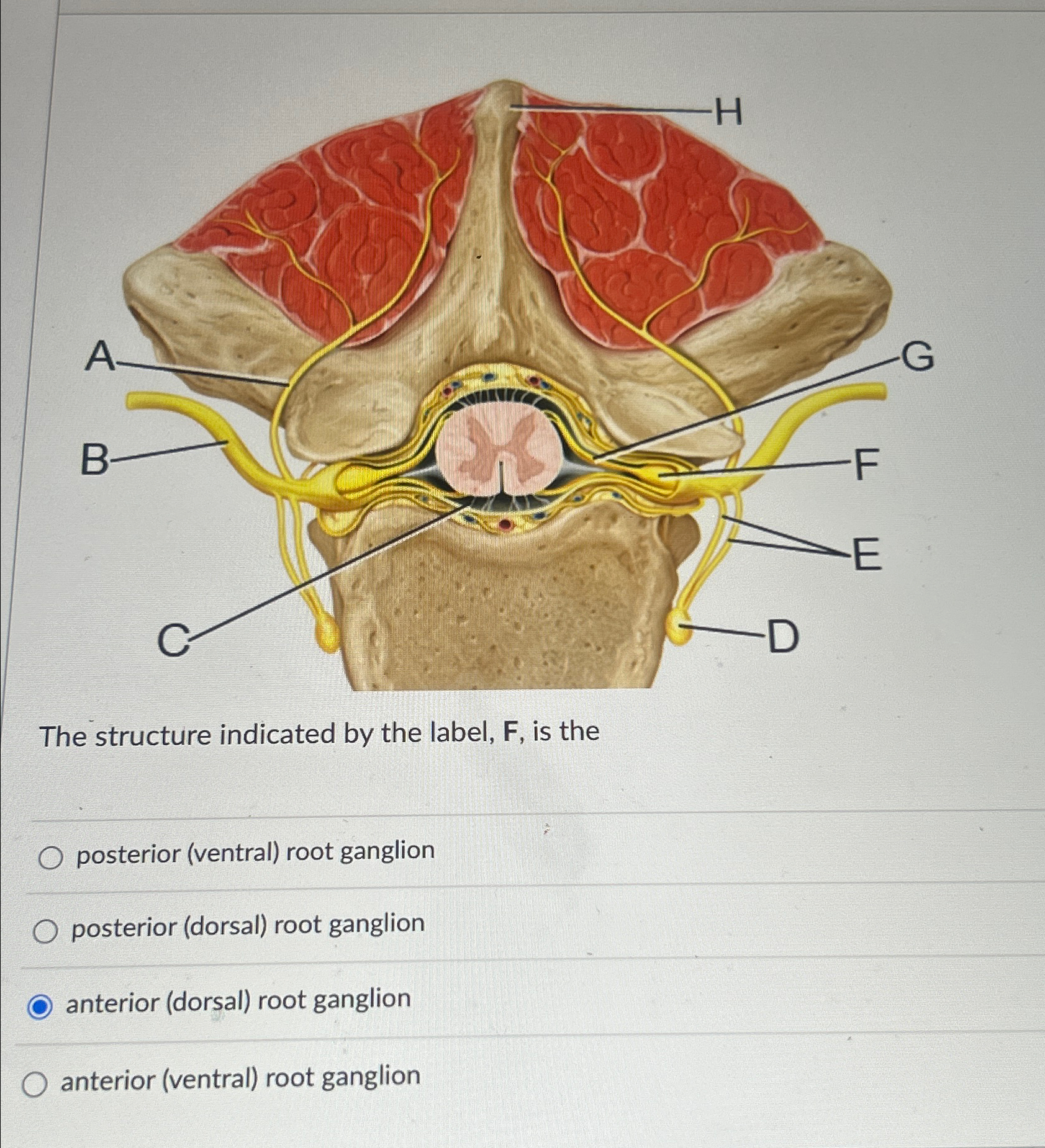 student submitted image, transcription available