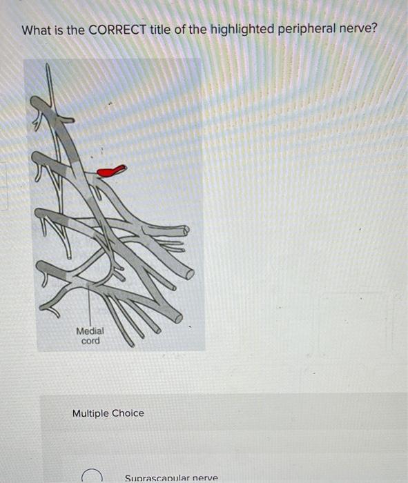 Solved What is the CORRECT title of the highlighted