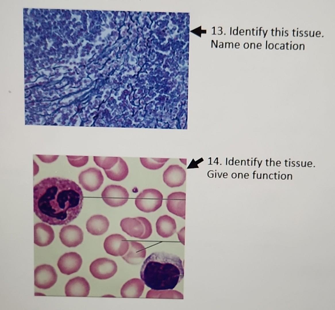 Solved - 13. Identify this tissue. Name one location 14. | Chegg.com