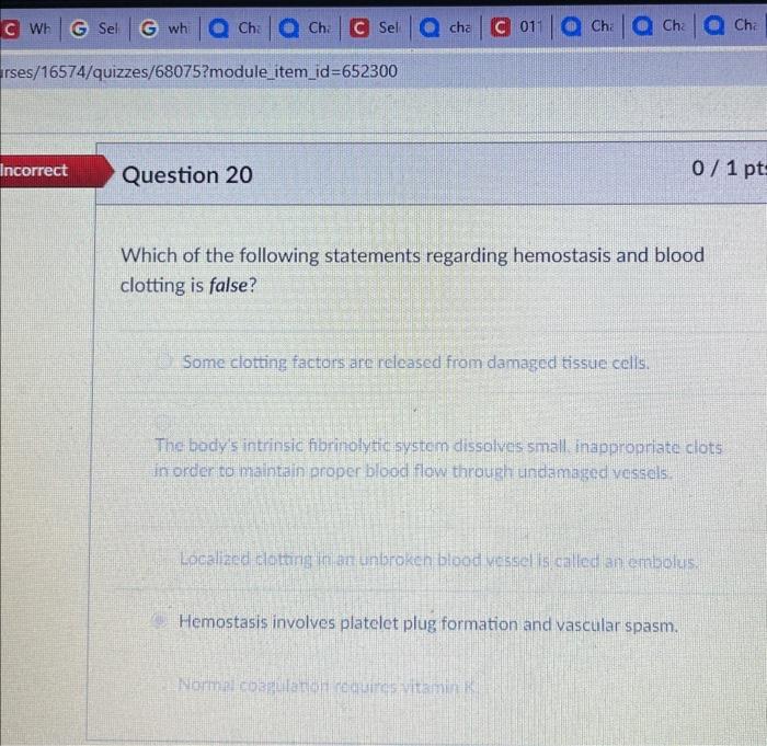 Solved Which of the following statements regarding | Chegg.com