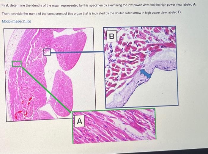 Solved First Determine The Identity Of The Organ Chegg Com