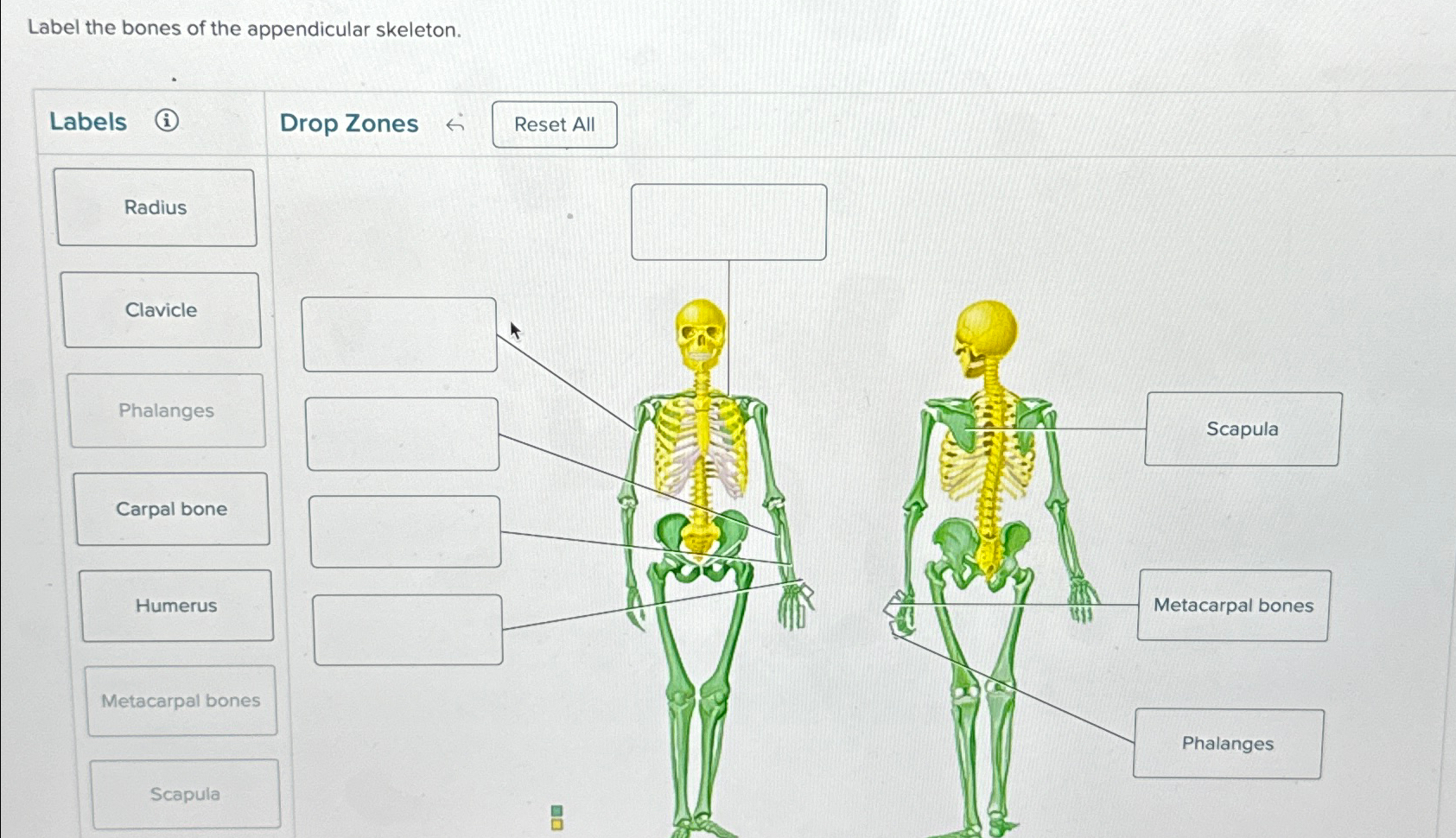 Solved Label the bones of the appendicular | Chegg.com