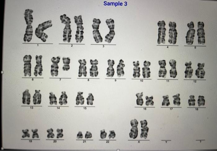 Solved Compare translocations in patients with lymphoma by | Chegg.com