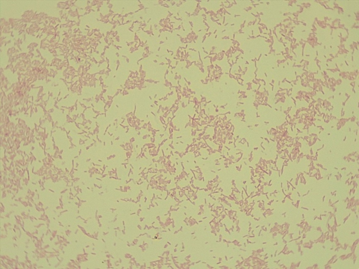 Solved What Is The Potential Bacteria Identity And Stain Of | Chegg.com