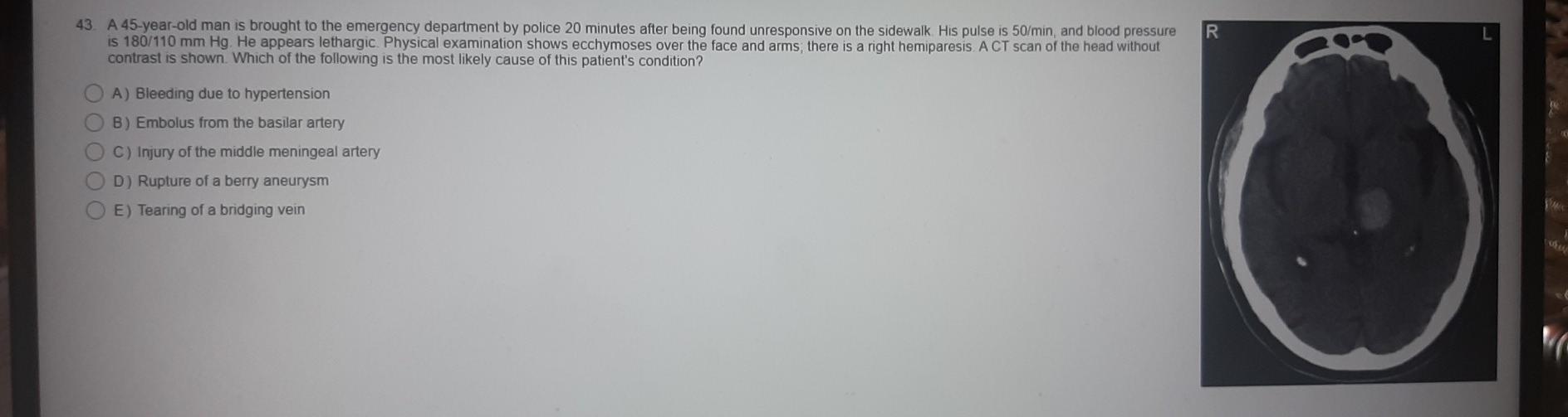 Solved R 43. A 45-year-old man is brought to the emergency | Chegg.com