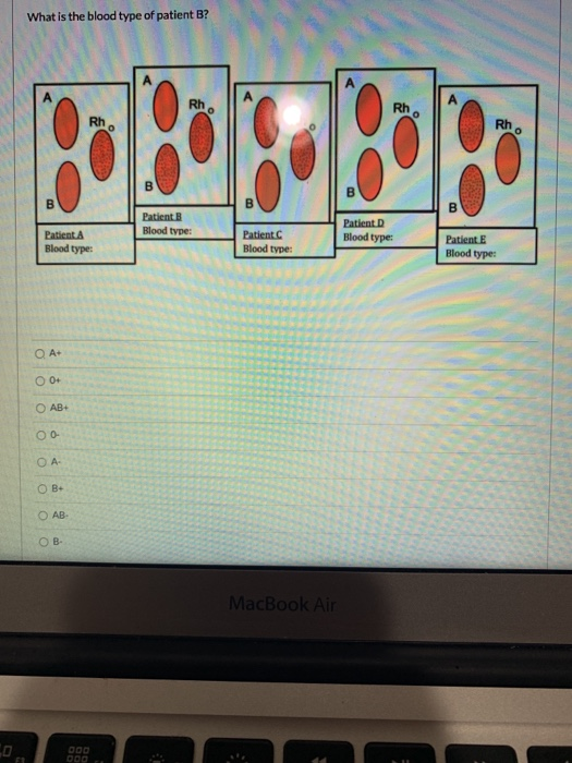 Solved What Is The Blood Type Of Patient B? Rho Rh Rh Rh B B | Chegg.com