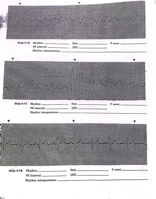 Solved Strip 9-18. Rhythm: Rate: P wave: PR interval: QRS: | Chegg.com