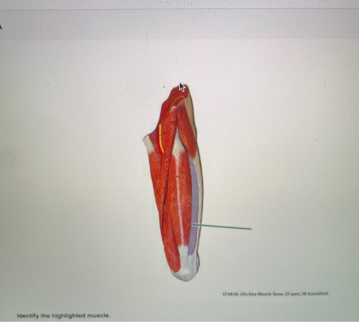 Solved nb - Attempt 1 stem - Lower Limb &gt; Lab Practical &gt; | Chegg.com