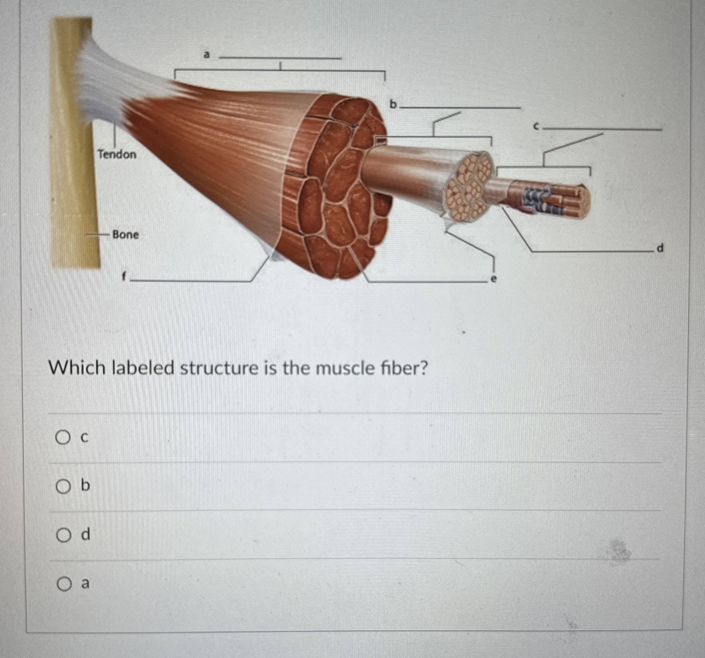 Solved Which labeled structure is the muscle fiber? ﻿C | Chegg.com