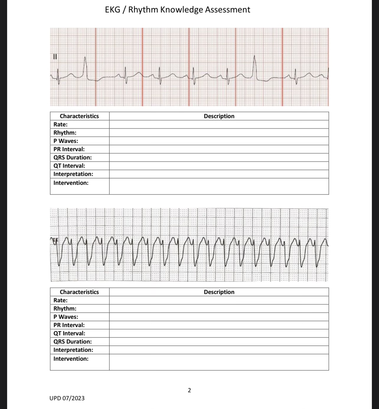 Ekg ï Rhythm Knowledge Chegg