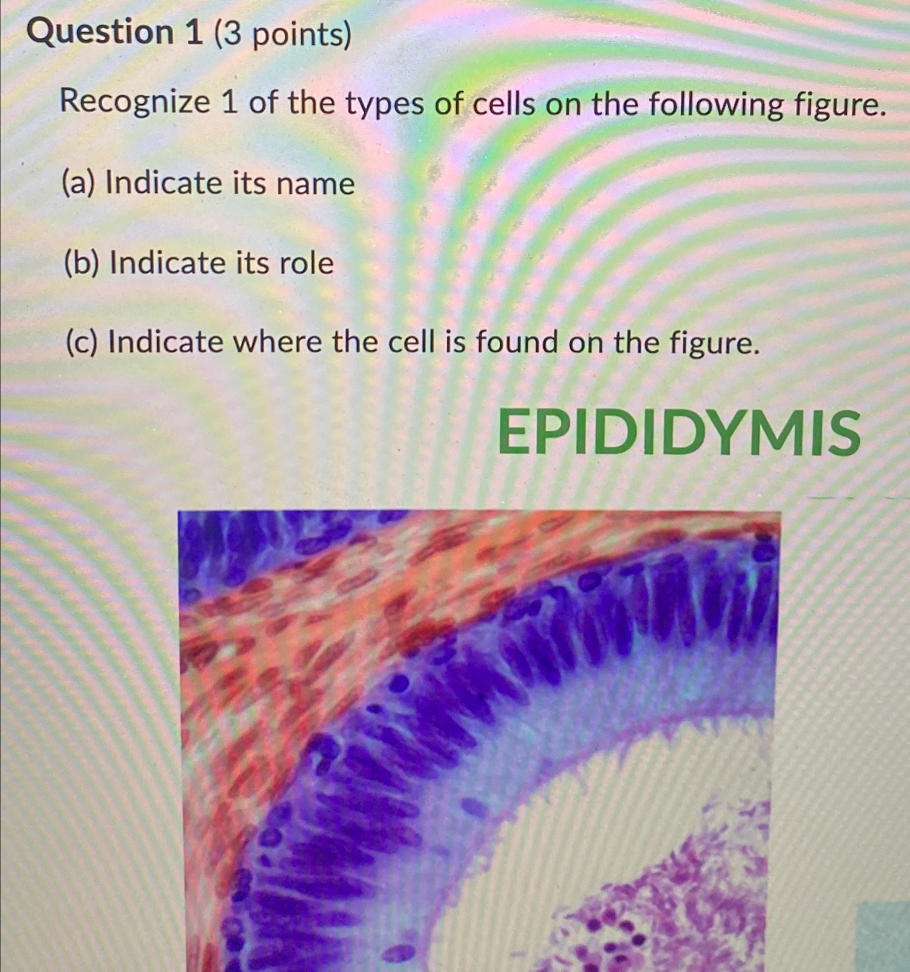 Solved Question 1 (3 ﻿points)Recognize 1 ﻿of The Types Of | Chegg.com