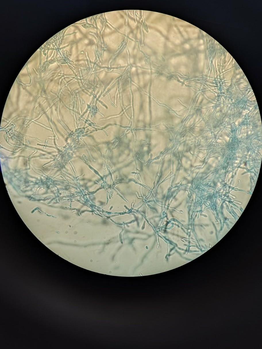 Solved What is the genus name of this fungal sample knowing | Chegg.com