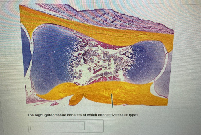 Solved The Highlighted Tissue Consists Of Which Connective 