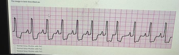 Solved what ecg ? | Chegg.com