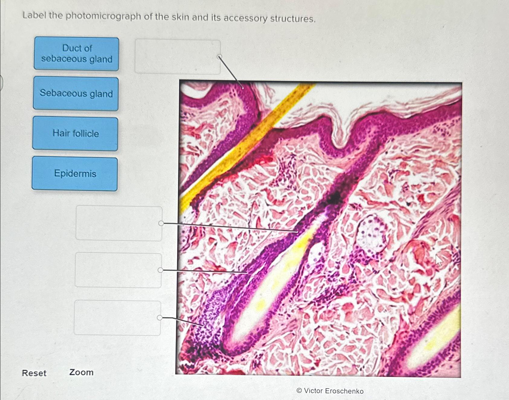 Solved Label The Photomicrograph Of The Skin And Its Chegg Com