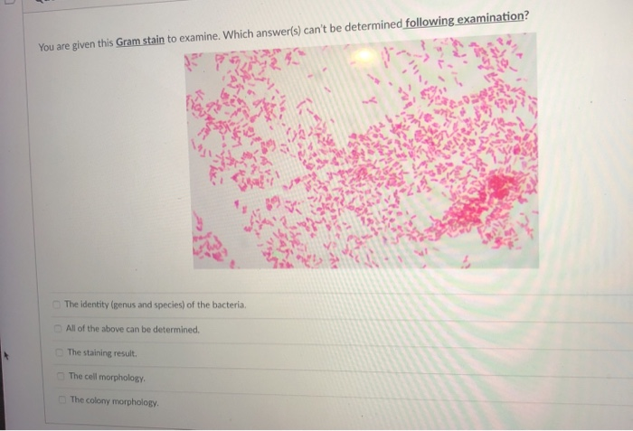 Solved You are given this Gram stain to examine. Which | Chegg.com