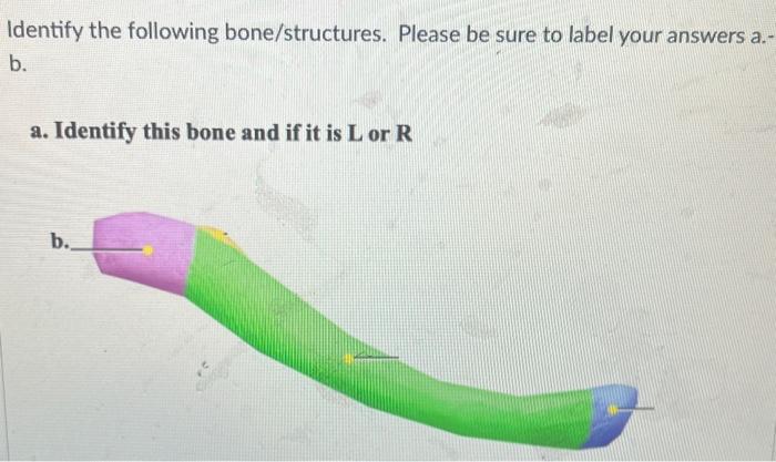 Solved Identify The Following Bone/structures. Please Be | Chegg.com