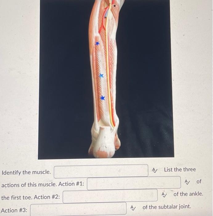 Solved Identify the muscle. actions of this muscle. Action | Chegg.com