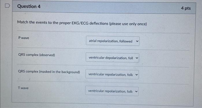 Match the events to the proper EKG/ECG deflections | Chegg.com