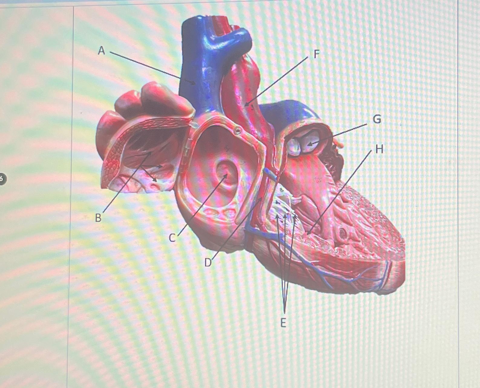 Solved Identify the ridges labeled BIdentify the depression | Chegg.com