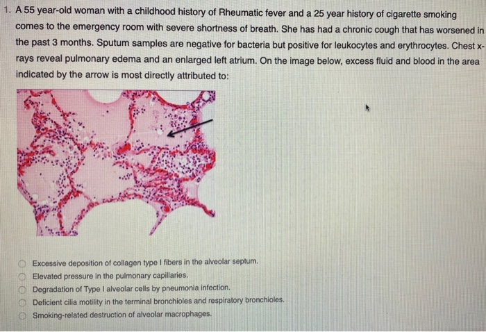 Solved 1. A 55 year-old woman with a childhood history of | Chegg.com