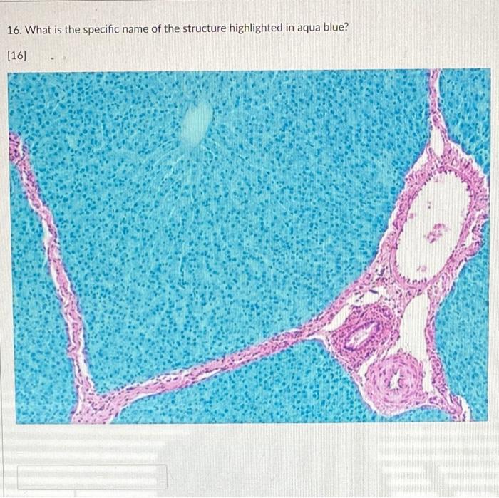 Solved 16. What is the specific name of the structure | Chegg.com