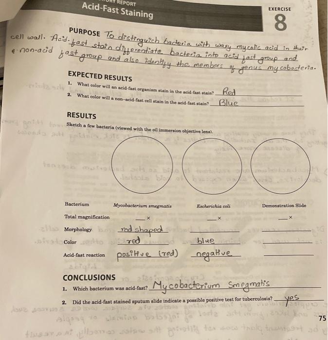 Solved AcidFast Staining REPORT EXERCISE 8 cell wall.