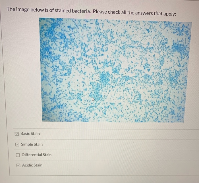 Solved Which type of stain releases and H+ ion: simple stain | Chegg.com