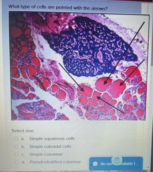 Solved What type of cells are pointed with the arrows? | Chegg.com