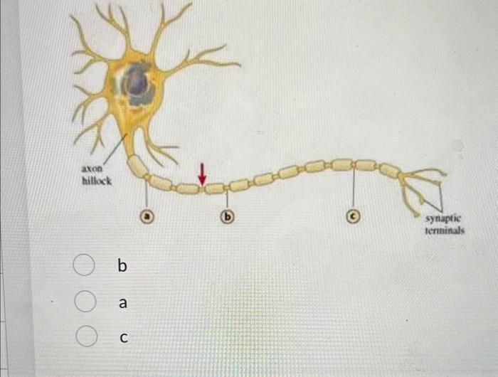 Solved B A C | Chegg.com