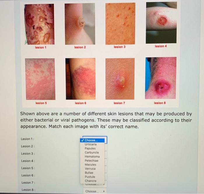 skin lesions chart