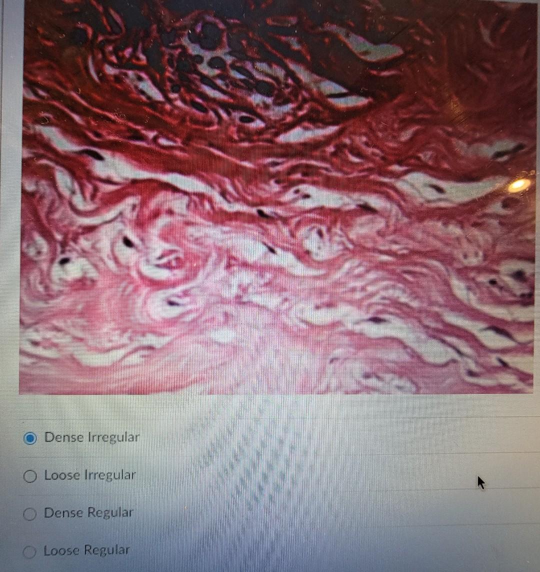 Solved Dense Irregular Loose Irregular O Dense Regular O | Chegg.com
