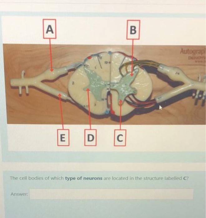 Solved ΑΙ B Autograp E D с The cell bodies of which type of | Chegg.com