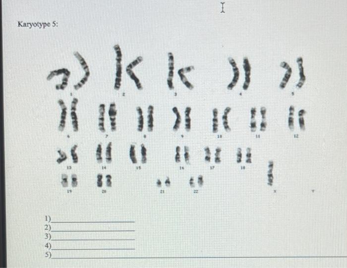 Solved Determine if each of these karyotypes is. 1) Euploid | Chegg.com