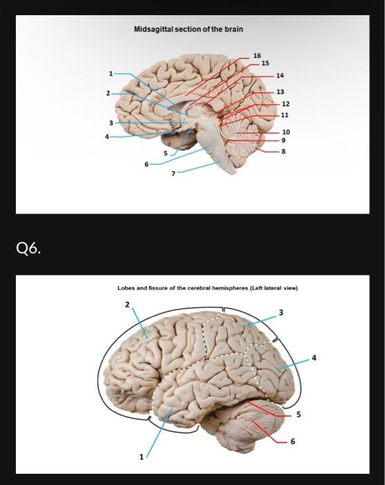 Solved Midsagittal section of the brain Lobes and fissure of | Chegg.com