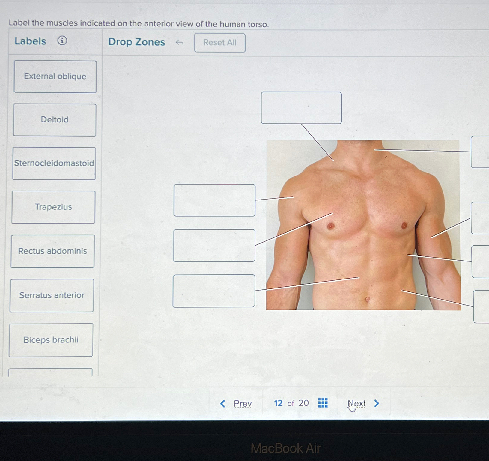 Solved Label the muscles indicated on the anterior view of | Chegg.com