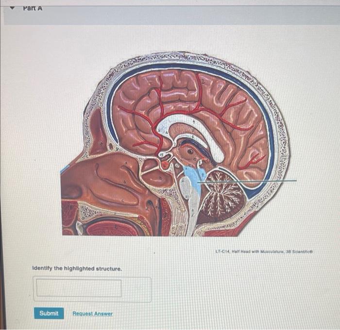 Solved Part A TUK LT-C14. Hall Head with Musculatur, Je | Chegg.com