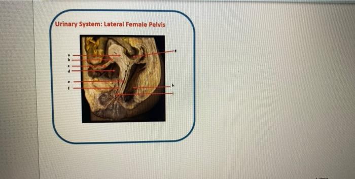 Solved Urinary System: Lateral Female Pelvis SV & Second | Chegg.com