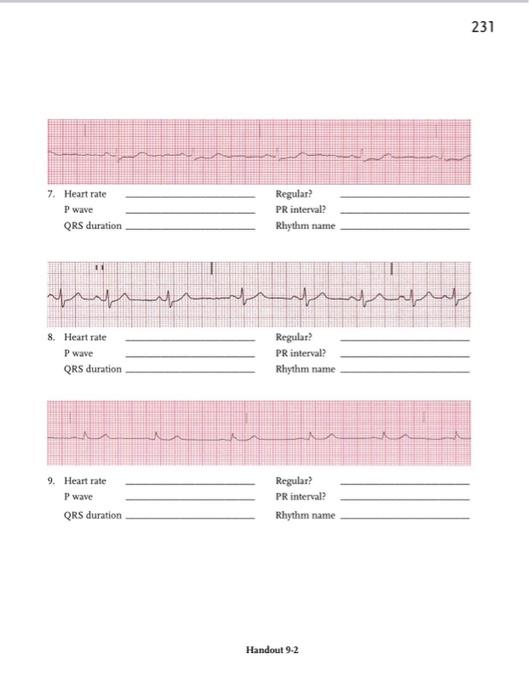 Solved 7. Heart rate Regular? P wave PR interval? QRS | Chegg.com