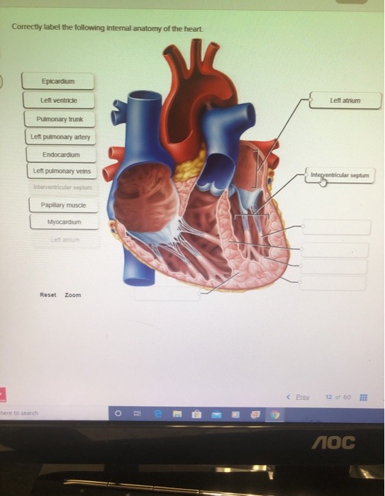 Solved Correctly label the following internal anatomy of the | Chegg.com