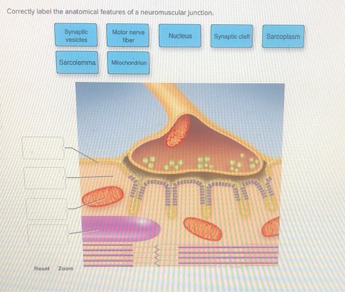 Solved Correctly label the anatomical features of a | Chegg.com