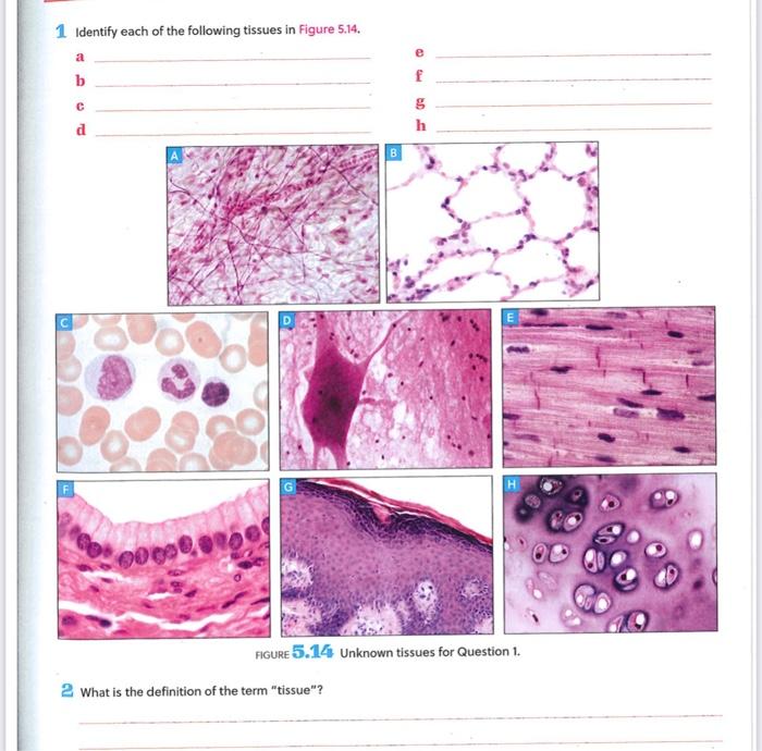 1 Identify each of the following tissues in Figure | Chegg.com