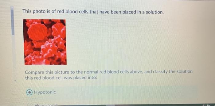 Solved This photo is of red blood cells that have been | Chegg.com