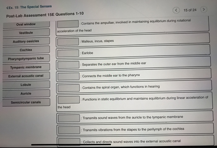 Solved Ex 15 The Special Senses 13 Of 24 Post Lab Chegg Com