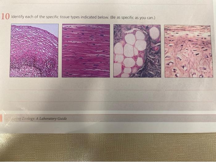 Solved 10 Identify each of the specific tissue types | Chegg.com