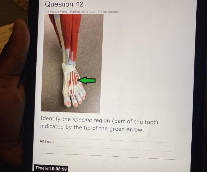 Question 42 Not yet answered Marked out of 1.00 P Flag question Identify the specific region (part of the foot) indicated by