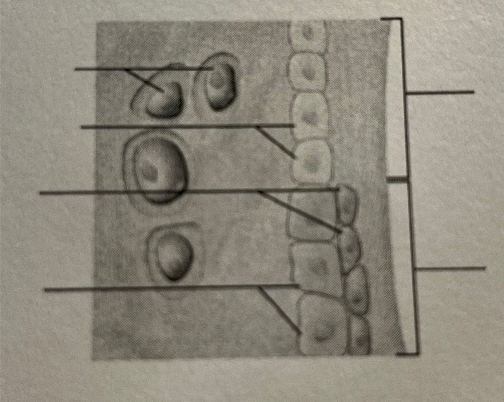 Solved What stage of the endochondral ossifcation | Chegg.com